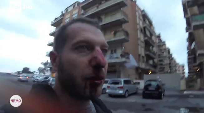 Roberto Spada aggredisce troupe di Nemo, inviati tv manifestano ad Ostia